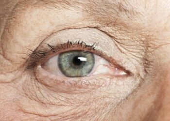 Research suggests that monitoring eye health could help detect Alzheimer's and dementia at an earlier stage.